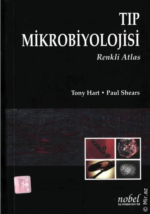 Tony Hart & Paul Shears "Tıp Mikrobiyolojisi Renkli Atlas" PDF
